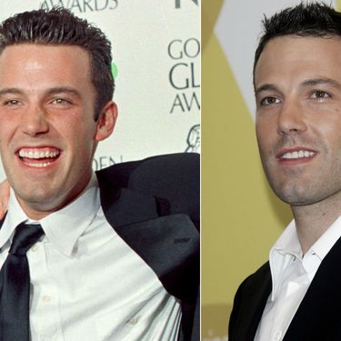 Slavni muškarci prije i nakon što su sredili zube - 1