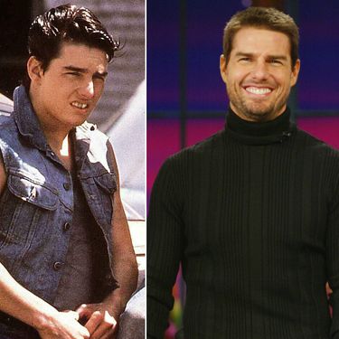 Slavni muškarci prije i nakon što su sredili zube - 2