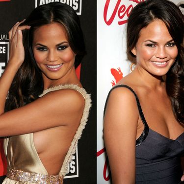 Slavne dame koje su priznale plastične operacije - 1