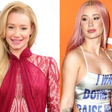 Slavne dame koje su priznale plastične operacije - 2