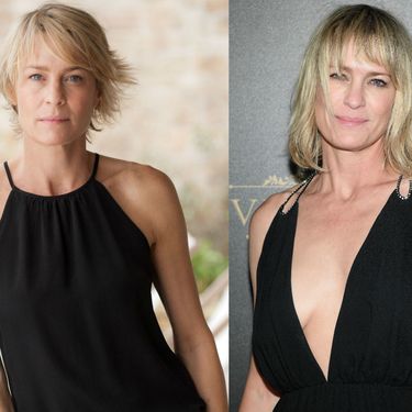 Slavne dame koje su priznale plastične operacije - 4