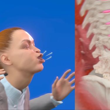 Simulacije ozljede Victorije Kenny koja je kihanje ozlijedila kralježnicu