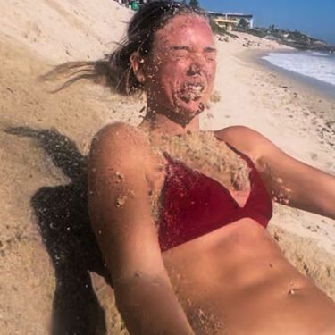 Nezgoda na plaži
