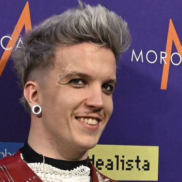 Baby Lasagna kod oka ima lažnu bijelu tetovažu