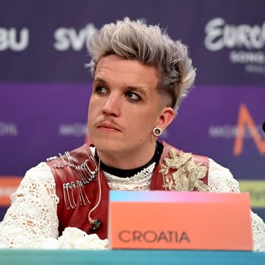 Baby Lasagna kod oka ima imitaciju bijele tetovaže u obliku čipke