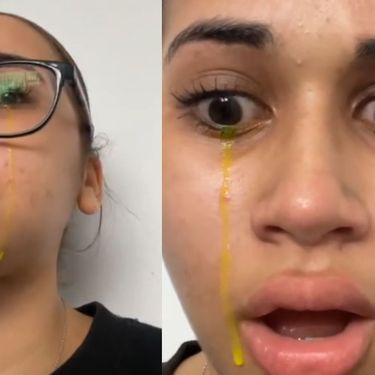 Žena plaće žute suze i gleda u kameru