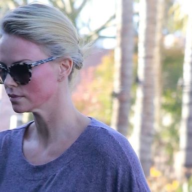 Slavne žene koje je dobar ten \'iznevjerio\' - 3