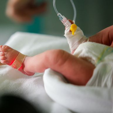 Prijevremeno rođena beba