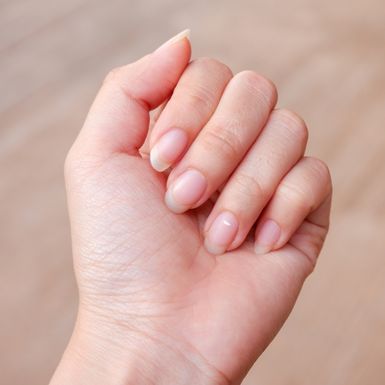 Bijele mrlje na noktima