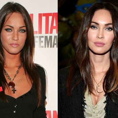 Nekad i sad: Slavne žene koje su povećale usne - 1