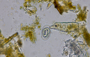 Jajašce parazita u uzorku stolice,ilustracija