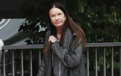 Janice Dickinson zabrinula obožavatelje izgledom lica