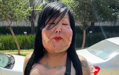 Juliana Oliveira nakon estetske korekcije živi s katastrofalnim posljedicama