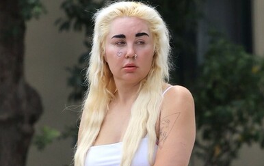 Amanda Bynes daleko je od ljepotice kakvu pamtimo, a njezino novo izdanje mnoge je ostavilo bez riječi