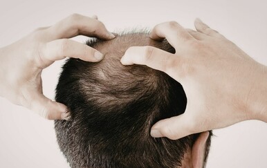 Karta otkrila zemlje s najvećim postotkom ćelavih muškaraca: Pogledajte gdje stoji Hrvatska?