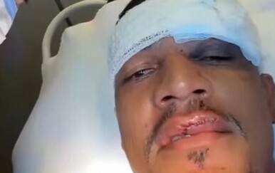 VIDEO Bivši hajdukovac operiran poslije teškog nokauta: Liječnik objavio video