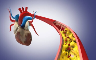 Ovu granicu kolesterola morate znati – smanjuje rizik od infarkta čak za 33 %!