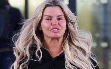 Kerry Katona podvrgnula se zahvatu nakon sumnji na moždani udar