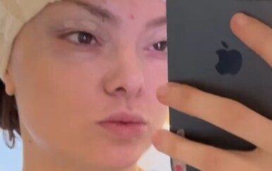 Ella Dvornik na Instagramu otkrila da je bila na estetskom zahvatu