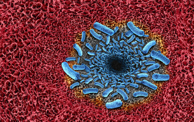 Bakterija koja jede meso: Simptomi, opasnosti i zašto je poluslana voda rizična