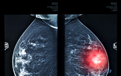 Revolucionarni biološki atlas otkriva: Zašto rizik od raka dojke naglo raste s godinama?