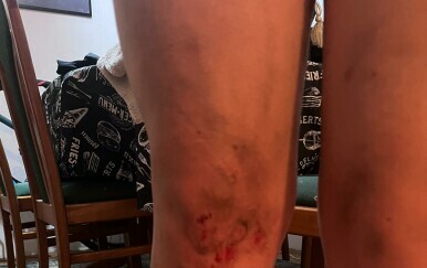 Ozlijeđena djevojka - 5