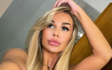 Louise iz Boltona zamalo umrla od sepse nakon BBL zahvata