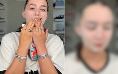 Koliko dlačica zapravo imamo na licu? Jedna je djevojka pokazala i iznenadila mnoge