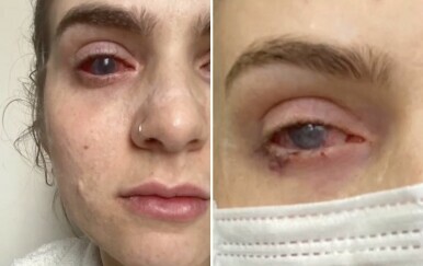 Popila je tabletu protiv bolova koju uzmaju brojni Hrvati, a onda joj se život zauvijek promijenio: "Bilo je kao da sam iznutra izgorjela"