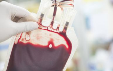 Novo istraživanje otkriva skriva li se u transfuziji krvi dosad nepoznat rizik za pacijente od Alzheimerove bolesti