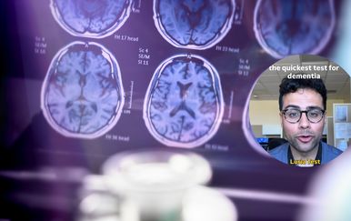 Neurolog otkriva brzi test za demenciju od tri pokreta koji može biti važan pokazatelj