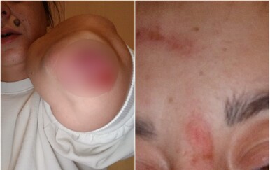 Napadnuta Nives Arnautović