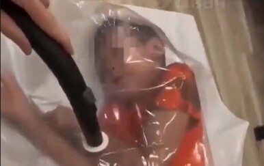 VIDEO Ruska influencerica šokirala internet: Majka vakuumirala sina u vrećicu pa se našalila na račun kisika