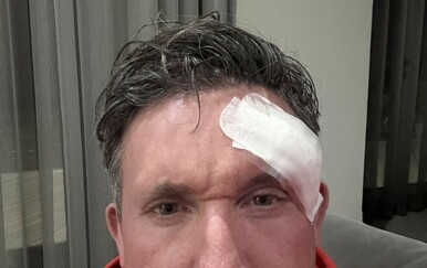 Legenda Liverpoola operirala rak i upozorila: "Provjerite mrlje na licu"