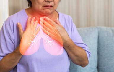 Rak pluća: Simptomi kod žena koji se često pripisuju drugim stvarima