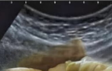 Ovako izgleda želudac svakog Balkanca! Urnebesna fora osvojila regiju