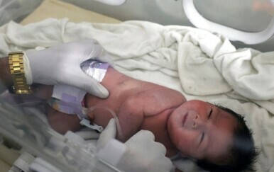 Beba rođena pod ruševinama u Siriji - 2