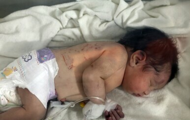 Beba rođena pod ruševinama u Siriji - 3