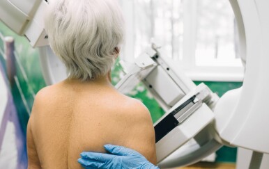Kada starije žene mogu prestati s mamografskim pregledima?