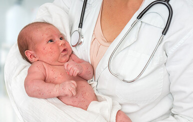 Širi se epidemija zaboravljene bolesti, dr. Oz uputio apel: "Molim vas, cijepite se"