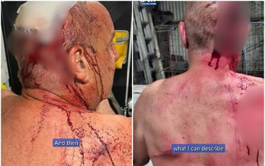 Umirovljenik teško ozlijeđen u brutalnom napadu klokana u Australiji