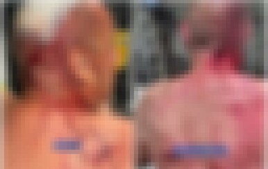 Umirovljenik teško ozlijeđen u brutalnom napadu klokana u Australiji