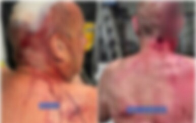 Umirovljenik teško ozlijeđen u brutalnom napadu klokana u Australiji