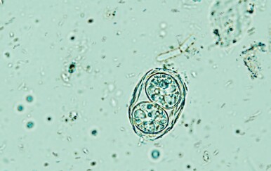 Ovaj parazit ima trećina ljudi, a znanstvenici tek sada shvaćaju koliko je opasan!