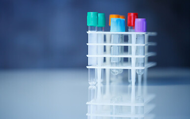 Imaš pravo znati: Studenti u ovom gradu danas se mogu besplatno testirati na HIV i hepatitis C