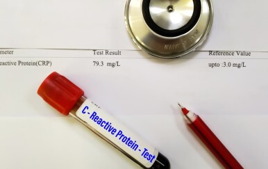 Hrana koja smanjuje CRP: Što jesti da upala prođe prirodnim putem?