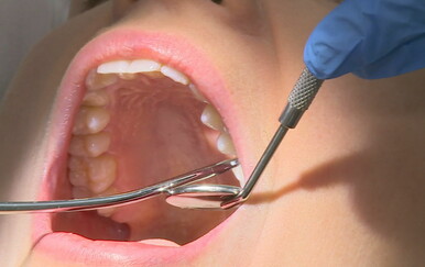 Poražavajuće stanje oralnog zdravlja na istoku Hrvatske