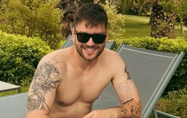 Sandi Pego ponovno otišao na transplantaciju kose u Tursku