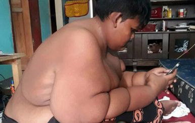 Najdeblji dječak na svijetu smršavio 75 kilograma (Foto: Profimedia)