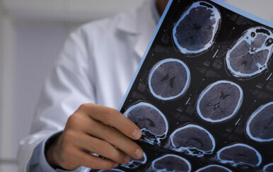 Liječnik promtra MRI snimku mozga, ilustracija